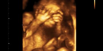 Donne in affitto, bambini in vendita. La dignità umana del concepito e l’utero in affitto. Rimini, 7 settembre 2023